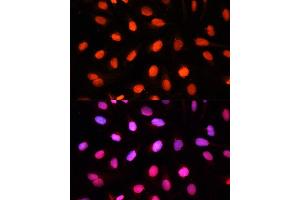 Immunofluorescence analysis of U2OS cells using NSUN2 antibody (ABIN1681117, ABIN3017797, ABIN3017798 and ABIN6220260) at dilution of 1:100.