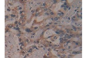Immunohistochemistry (IHC) image for anti-Proteasome (Prosome, Macropain) 26S Subunit, Non-ATPase, 13 (PSMD13) (AA 1-378) antibody (ABIN7442168)