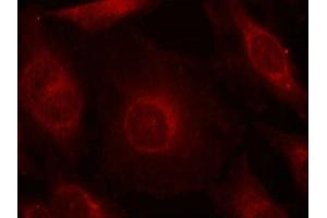 Immunofluorescence staining of methanol-fixed Hela cells using AKT1/AKT2/AKT3(phospho-Tyr315/316/312) Antibody. (AKT 1/2/3 抗体  (pTyr312, pTyr315, pTyr316))