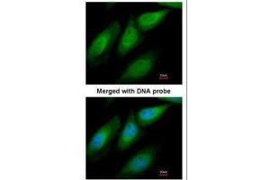ICC/IF Image Immunofluorescence analysis of paraformaldehyde-fixed HeLa, using SUGT1, antibody at 1:200 dilution. (SUGT1 抗体  (Center))