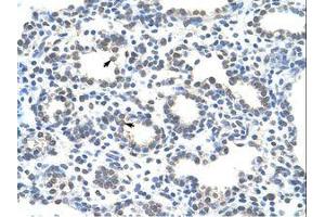 Image no. 1 for anti-Zinc Finger Protein 265 (Zranb2) (AA 149-198) antibody (ABIN6736297) (ZNF265 抗体  (AA 149-198))