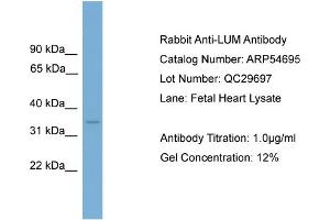 WB Suggested Anti-LUM  Antibody Titration: 0. (LUM 抗体  (Middle Region))