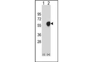 Western blot analysis of PDHA1 (arrow) using PDHA1 Antibody . (PDHA1 抗体)