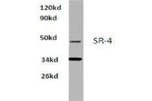 Western blot analysis of SR-4 Antibody  in extracts from Hela cells at 1/500 dilution. (Serotonin Receptor 4 抗体)
