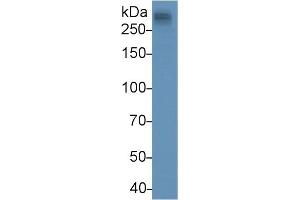 Detection of APOB in Human Serum using Monoclonal Antibody to Apolipoprotein B (APOB) (APOB 抗体  (AA 3365-3548))