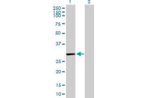 Western Blot analysis of C10orf63 expression in transfected 293T cell line by C10orf63 MaxPab polyclonal antibody. (ENKUR 抗体  (AA 1-256))