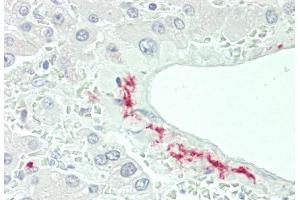 Formalin-fixed and paraffin-embedded H. (CFHR5 抗体  (AA 203-231))