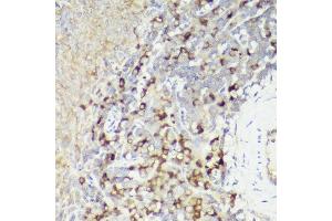 Immunohistochemistry of paraffin-embedded rat spleen using IL18 antibody (ABIN7267992) at dilution of 1:50 (40x lens). (IL-18 抗体)