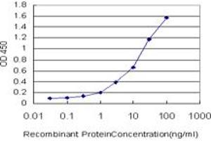 Detection limit for recombinant GST tagged CAMK2B is approximately 0. (CAMK2B 抗体  (AA 1-503))