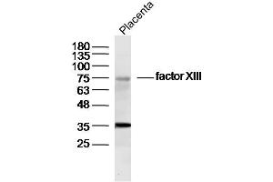 Mouse placenta lysates probed with factor XIII Polyclonal Antibody, Unconjugated  at 1:300 dilution and 4˚C overnight incubation. (Factor XIII 抗体  (AA 331-732))