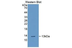 Detection of Recombinant PLXNB1, Human using Polyclonal Antibody to Plexin B1 (PLXNB1) (PLXNB1 抗体  (AA 200-727))