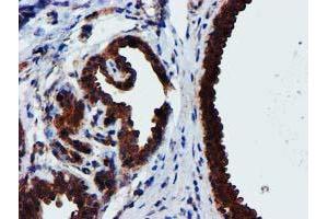 Immunohistochemical staining of paraffin-embedded Human breast tissue using anti-EPN2 mouse monoclonal antibody. (Epsin 2 抗体)