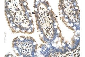 Complement C8b antibody was used for immunohistochemistry at a concentration of 4-8 ug/ml. (C8B 抗体  (Middle Region))