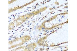 Immunohistochemistry of paraffin-embedded Human stomach using UBE2L3 Polyclonal Antibody at dilution of 1:100 (40x lens). (UBE2L3 抗体)