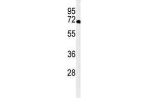 Western blot analysis of XRCC6 antibody and A2058 lysate. (XRCC6 抗体  (AA 521-548))