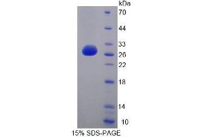 SDS-PAGE analysis of Human LYPLA1 Protein. (LYPLA1 蛋白)