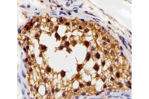 Immunohistochemical analysis of paraffin-embedded human testis section using VEGFR3 antibody at 1:25 dilution. (FLT4 抗体)