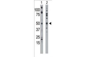 The anti-EKI1 Pab (ABIN391086 and ABIN2841227) is used in Western blot to detect EKI1 in mouse bladder tissue lysate (Lane 1) and 293 cell lysate (Lane 2). (Ethanolamine Kinase 1 抗体  (N-Term))