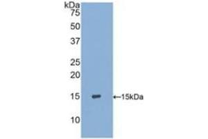 Detection of Recombinant S100A9, Human using Polyclonal Antibody to S100 Calcium Binding Protein A9 (S100A9) (S100A9 抗体  (AA 1-114))