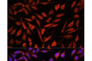Immunofluorescence analysis of L929 cells using FBXO21 Polyclonal Antibody at dilution of 1:100. (FBXO21 抗体)