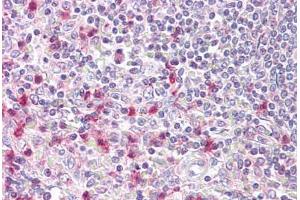 Anti-NFAT5 antibody IHC staining of human spleen. (NFAT5 抗体  (AA 1171-1220))