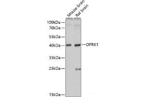Western blot analysis of extracts of various cell lines using OPRK1 Polyclonal Antibody at dilution of 1:1000. (OPRK1 抗体)