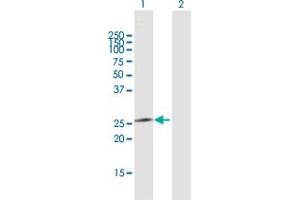 Western Blot analysis of IL24 expression in transfected 293T cell line by IL24 MaxPab polyclonal antibody. (IL-24 抗体  (AA 1-206))