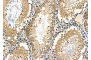 ABIN6261885 and ABIN6277125 at 1/100 staining Rat testis tissue by IHC-P. (GAS2L1 抗体  (C-Term))