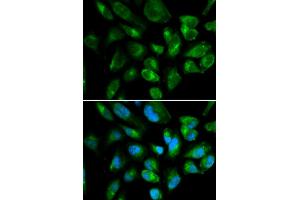 Immunofluorescence analysis of HepG2 cells using KIR2DL3 antibody (ABIN3212244). (KIR2DL3 抗体)