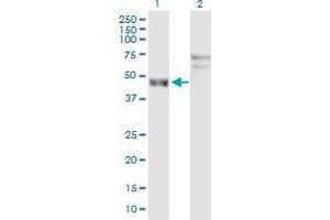 Lane 1: ARL6IP4 transfected lysate ( 38. (ARL6IP4 293T Cell Transient Overexpression Lysate(Denatured))