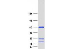 Western Blotting (WB) image for Asparaginase Like 1 (ASRGL1) (Transcript Variant 1) protein (Myc-DYKDDDDK Tag) (ABIN2724439)