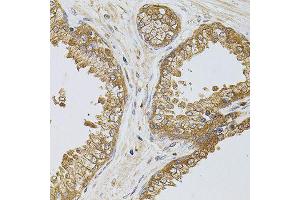 Immunohistochemistry of paraffin-embedded human prostate using TEFM antibody (ABIN5974873) at dilution of 1/100 (40x lens). (TEFM 抗体)