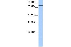 WB Suggested Anti-ADAD2 Antibody Titration:  0. (ADAD2 抗体  (C-Term))