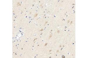 anti-Cyclin-Dependent Kinase 5 (CDK5) (AA 1-226) antibody