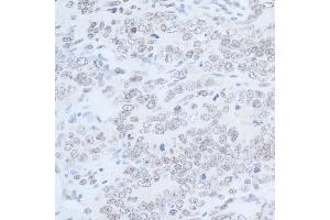 Immunohistochemistry (IHC) image for anti-Rad6 (N-Term) antibody (ABIN7449403) (Rad6 (N-Term) 抗体)