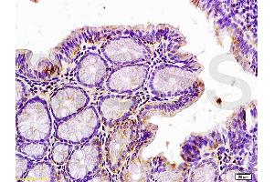 Formalin-fixed and paraffin embedded rat colitis tissue labeled with Anti-Phospho-IRAK1 (Thr209) Polyclonal Antibody, Unconjugated (ABIN742658) at 1:200 followed by conjugation to the secondary antibody and DAB staining (IRAK1 抗体  (pThr209))