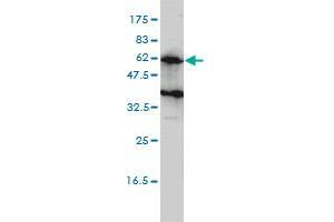 KIRREL2 monoclonal antibody (M01), clone 2B9-1D3 Western Blot analysis of KIRREL2 expression in Hela S3 NE . (KIRREL2 抗体  (AA 1-219))