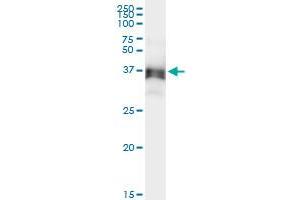 Immunoprecipitation of ACAD8 transfected lysate using anti-ACAD8 MaxPab rabbit polyclonal antibody and Protein A Magnetic Bead , and immunoblotted with ACAD8 purified MaxPab mouse polyclonal antibody (B01P) . (Acad8 抗体  (AA 1-415))