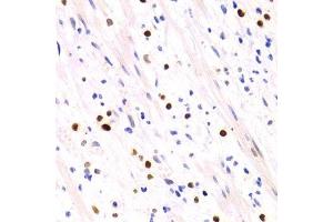 Immunohistochemistry of paraffin-embedded human vermiform appendix using GEMIN2 Antibody. (SIP1 抗体)
