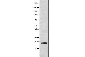 Western blot analysis of MRPL30 using HeLa whole cell lysates (MRPL30 抗体  (Internal Region))