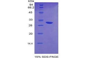 SDS-PAGE analysis of Mouse EGR2 Protein. (EGR2 蛋白)