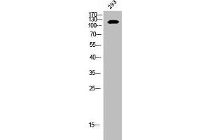 Western Blot analysis of 293 cells using EphB2 Polyclonal Antibody (EPH Receptor B2 抗体  (C-Term))