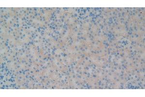 Detection of GP1BB in Rat Kidney Tissue using Polyclonal Antibody to Platelet Glycoprotein Ib Beta Chain (GP1BB) (GP1BB 抗体  (AA 52-164))