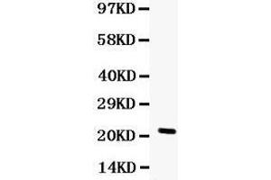 Observed bind size: 22KD (G-CSF 抗体  (AA 47-208))