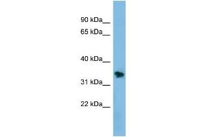 WB Suggested Anti-NSMCE1 Antibody Titration: 0. (NSMCE1 抗体  (Middle Region))