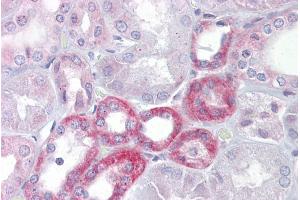 Immunohistochemistry with Kidney tissue at an antibody concentration of 5µg/ml using anti-KL antibody (ARP41551_P050) (Klotho 抗体  (Middle Region))