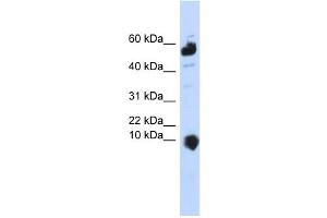 WB Suggested Anti-C1orf151 Antibody Titration:  0. (C1orf151 抗体  (Middle Region))