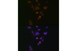 Immunofluorescence analysis of U-2 OS cells using NUP153 Rabbit mAb (ABIN1512527, ABIN3023298, ABIN3023299 and ABIN7101477) at dilution of 1:100 (40x lens). (NUP153 抗体)