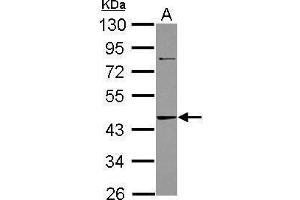 WB Image Sample (30 ug of whole cell lysate) A: A431 10% SDS PAGE antibody diluted at 1:1000 (ADK 抗体)