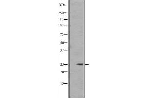 Western blot analysis of FGF8 expression in Jurkat cell lysate in RIPA buffer ,The lane on the left is treated with the antigen-specific peptide. (FGF8 抗体  (Internal Region))